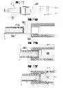 Fig. 08 - Systems and methods for ensuring safe and rapid deployment of prosthetic heart valves