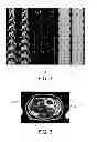Fig. 03 - MR imaging using a multi-point dixon technique