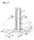 Fig. 27 - Multi-Crystalline Silicon Ingot And Directional Solidification Furnace