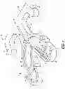 Fig. 02 - METHOD FOR PLANNING A DENTAL PROSTHESIS IMPLANT ARRANGEMENT AND A REFERENCE ARRANGEMENT