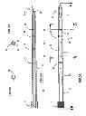 Fig. 05 - Hypodermic Needle With Multiple Dispersement Openings