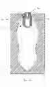 Fig. 02 - Personal Care Product