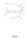 Fig. 09 - Endoscopic instruments and methods of manufacture