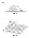 Fig. 02 - Hernia mesh apparatus and method