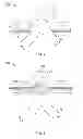 Fig. 03 - Hernia mesh apparatus and method