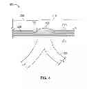 Fig. 04 - Hernia mesh apparatus and method