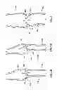 Fig. 02 - Percutaneous methods and apparatus for creating native tissue venous valves