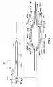 Fig. 04 - Percutaneous methods and apparatus for creating native tissue venous valves