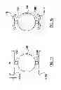 Fig. 10 - Percutaneous methods and apparatus for creating native tissue venous valves