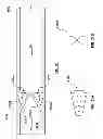 Fig. 16 - Percutaneous methods and apparatus for creating native tissue venous valves