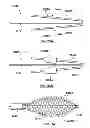Fig. 18 - Percutaneous methods and apparatus for creating native tissue venous valves