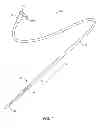 Fig. 02 - Method and system for treating valve stenosis