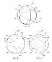 Fig. 07 - CUTTER ASSEMBLY WITH AT LEAST ONE ISLAND AND A METHOD OF MANUFACTURING A CUTTER ASSEMBLY