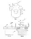 Fig. 16 - CUTTER ASSEMBLY WITH AT LEAST ONE ISLAND AND A METHOD OF MANUFACTURING A CUTTER ASSEMBLY