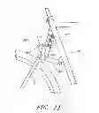 Fig. 12 - Bicycle damping enhancement system