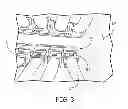 Fig. 04 - RFID READER EXTENDER