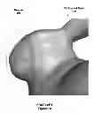 Fig. 02 - Volume-preserving smoothing brush
