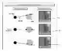 Fig. 01 - Image fusion for interventional guidance