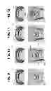 Fig. 07 - Fastener systems that provide EME protection