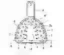 Fig. 01 - Impression tray for upper jaw