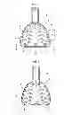 Fig. 02 - Impression tray for upper jaw