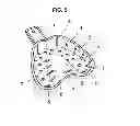 Fig. 04 - Impression tray for upper jaw