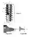 Fig. 02 - HIGH TORQUE DENTAL IMPLANT SYSTEM