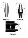Fig. 06 - HIGH TORQUE DENTAL IMPLANT SYSTEM