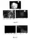 Fig. 35 - Composition
