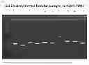 Fig. 02 - Compositions and methods for detection of microorganisms of the complex excluding 