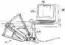 Fig. 01 - Systems and methods for accessing the lumen of a vessel