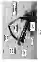 Fig. 03 - Systems and methods for accessing the lumen of a vessel