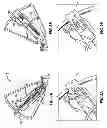 Fig. 12 - Systems and methods for accessing the lumen of a vessel