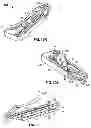 Fig. 13 - Systems and methods for accessing the lumen of a vessel