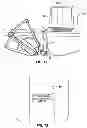 Fig. 14 - Systems and methods for accessing the lumen of a vessel