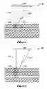 Fig. 17 - Systems and methods for accessing the lumen of a vessel