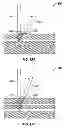 Fig. 18 - Systems and methods for accessing the lumen of a vessel