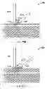 Fig. 20 - Systems and methods for accessing the lumen of a vessel