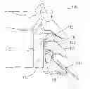 Fig. 01 - Method and tools for clearing the epidural space in preparation for medical lead implantation