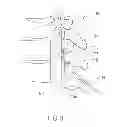 Fig. 04 - Method and tools for clearing the epidural space in preparation for medical lead implantation