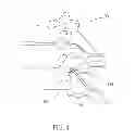 Fig. 05 - Method and tools for clearing the epidural space in preparation for medical lead implantation