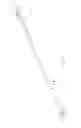 Fig. 08 - Method and tools for clearing the epidural space in preparation for medical lead implantation