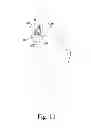 Fig. 06 - Method of implanting a glenoid defect-filling component