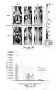 Fig. 06 - CANCER IMAGING WITH THERAPY: THERANOSTICS