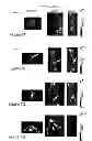 Fig. 09 - CANCER IMAGING WITH THERAPY: THERANOSTICS