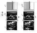 Fig. 11 - MAGNETIC RESONANCE IMAGING APPARATUS, AND IMAGING PARAMETER OPTIMIZING METHOD