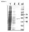 Fig. 07 - PEPTIDE CONTAINING MULTIPLE N-LINKED GLYCOSYLATION SEQUONS