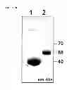 Fig. 08 - PEPTIDE CONTAINING MULTIPLE N-LINKED GLYCOSYLATION SEQUONS