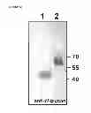 Fig. 09 - PEPTIDE CONTAINING MULTIPLE N-LINKED GLYCOSYLATION SEQUONS