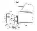 Fig. 06 - Mechanical method and apparatus for bilateral tissue fastening